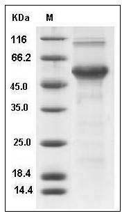 Human DMP1 Protein (His Tag) SDS-PAGE