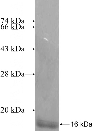 Human UBE2L6 Recombinant protein (6*His tag)