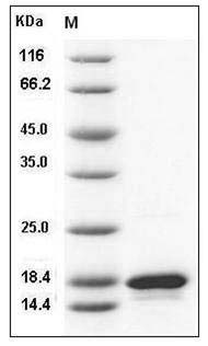 Human TNF-beta / TNFSF1 / Lymphotoxin alpha Protein SDS-PAGE