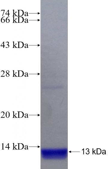 Recombinant Human C13orf37 SDS-PAGE