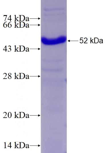 Recombinant Human YTHDF2 SDS-PAGE