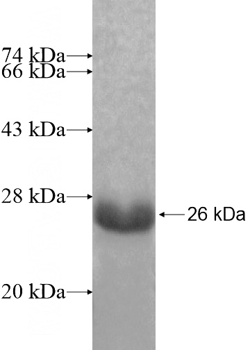 Recombinant Human TCEAL8 SDS-PAGE