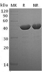 Human IDO1/IDO/INDO (His tag) recombinant protein