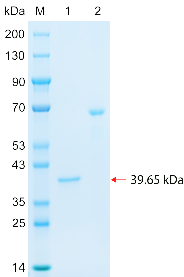 Recombinant SIK3 protein (His tag) SDS-PAGE