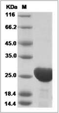 Rat AK1 / Adenylate kinase 1 Protein (His Tag)