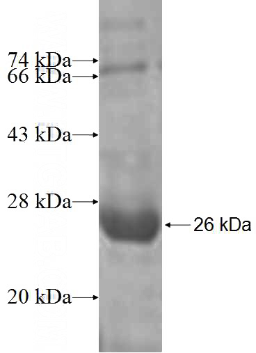 Recombinant Human C11orf73 SDS-PAGE