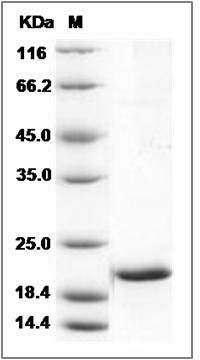 Human SRI / Sorcin Protein SDS-PAGE