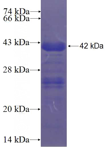 Recombinant Human LZTR1 SDS-PAGE