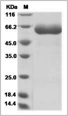 Rat IL-22R / IL22RA1 Protein (Fc Tag)