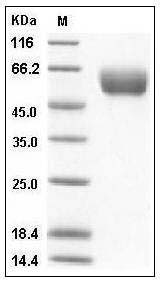 Human Angiotensinogen / SerpinA8 / AGT Protein (His Tag) SDS-PAGE