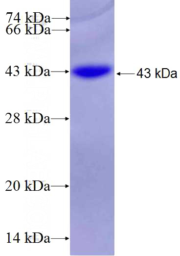 Recombinant Human WDR78 SDS-PAGE