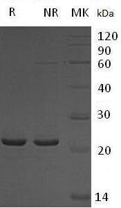 Human HSPB2 (His tag) recombinant protein
