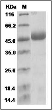 Human NAGA / Alpha-N-acetylgalactosaminidase Protein (His Tag) SDS-PAGE