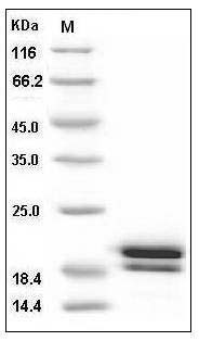 Human REG1B / PSPS2 Protein (His Tag) SDS-PAGE