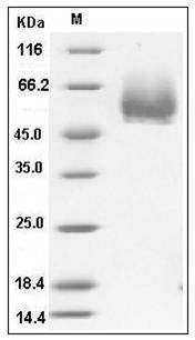 Mouse CD4 Protein (His Tag) SDS-PAGE