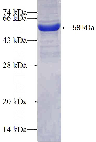 Recombinant Human METTL9 SDS-PAGE
