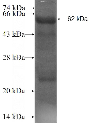 Recombinant Human ADAM32 SDS-PAGE