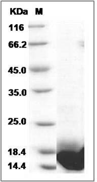 Human LSM3 Protein (His Tag) SDS-PAGE