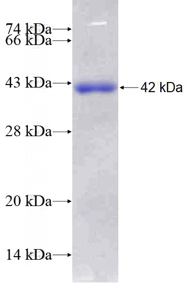 Recombinant Human MED23 SDS-PAGE