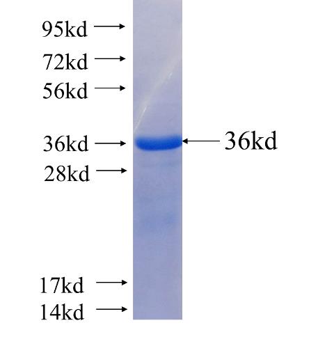 Recombinant human SRPRB SDS-PAGE