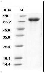 Influenza A H1N1 (A/California/04/2009) Hemagglutinin / HA Protein (His Tag) SDS-PAGE