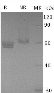 Mouse Ces1d/Ces1/Ces3 (His tag) recombinant protein