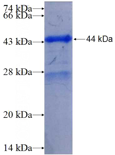 Human LAMB3 Recombinant protein (6*His tag)