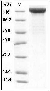 Human LIFR / CD118 Protein (His Tag) SDS-PAGE