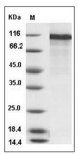 Human NELL2 Protein (His Tag) SDS-PAGE