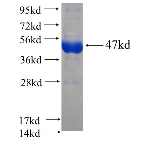 Recombinant human RTCD1(Full length) SDS-PAGE