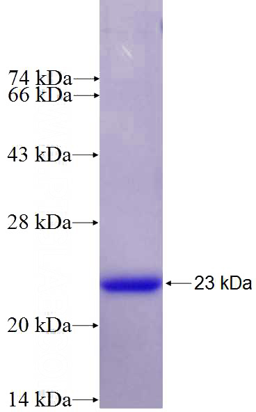 Recombinant Human IL-1B SDS-PAGE