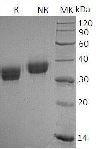 Human PDCD1LG2/B7DC/CD273/PDCD1L2/PDL2 (His tag) recombinant protein