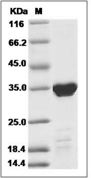 Human TPM1 / Tropomyosin-1 Protein (His Tag) SDS-PAGE