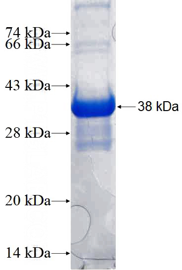 Recombinant Human CSTF3 SDS-PAGE