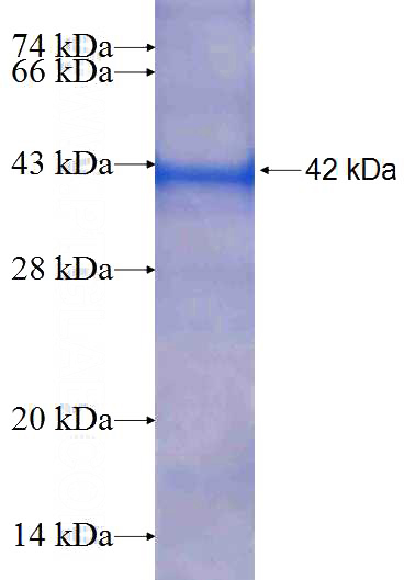 Recombinant Human THOC5 SDS-PAGE