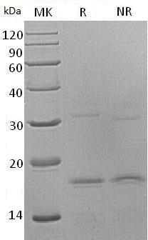 Human CXCL9/CMK/MIG/SCYB9 (His tag) recombinant protein