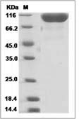 Mouse DPP4 / CD26 Protein (His Tag)