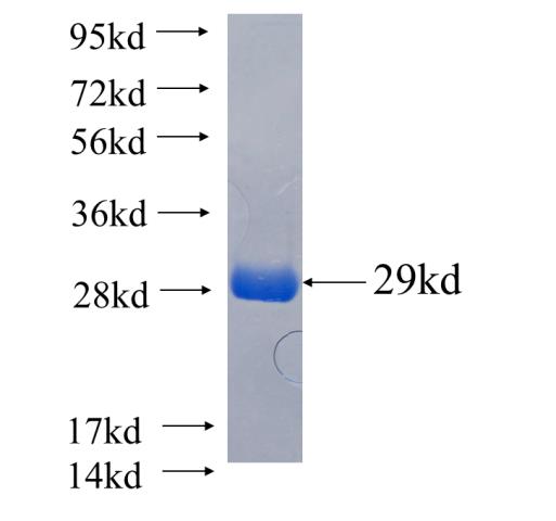 Recombinant human FAM158A SDS-PAGE