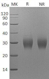 Human FBN1/FBN (His tag) recombinant protein