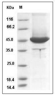 Human MSN / Moesin Protein (aa 1-346, His Tag) SDS-PAGE
