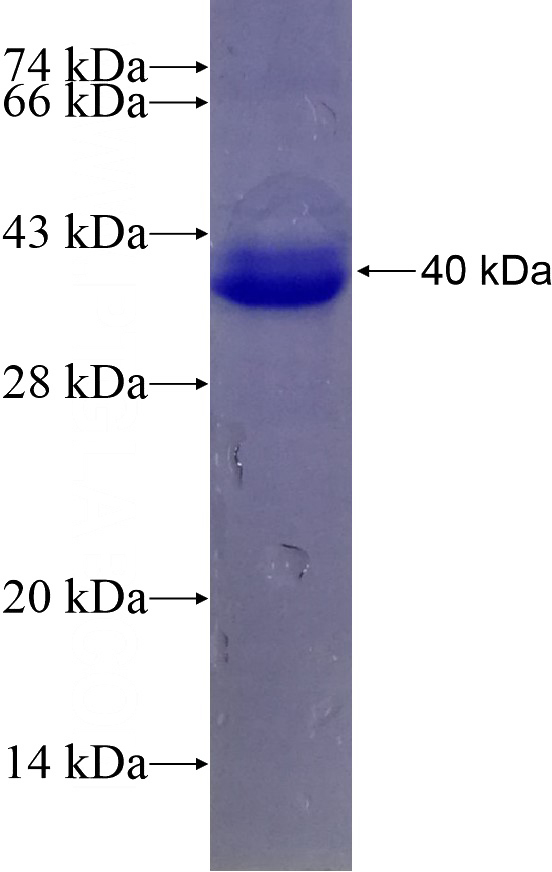 Recombinant Human UBP1 SDS-PAGE