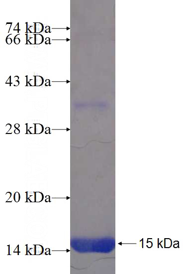 Recombinant Human AKR1D1 SDS-PAGE