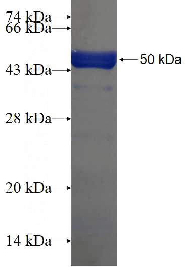 Recombinant Human CCDC105 SDS-PAGE