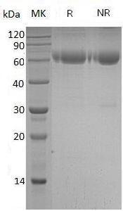Human SERPINA7/TBG (His tag) recombinant protein