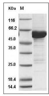 Human MKK6 / MEK6 / MAP2K6 Protein (207 Ser/Asp, 211 Thr/Asp, His & GST Tag) SDS-PAGE