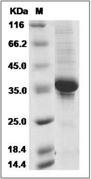 Human PLAC9 / Placenta-specific 9 Protein (Fc Tag) SDS-PAGE
