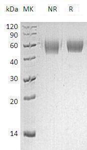 Human IL1R2/IL1RB (His tag) recombinant protein