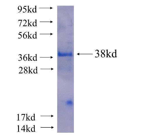 Recombinant human SH3BGRL2(Full length) SDS-PAGE