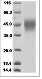 Human FCGR3B recombinant protein (C-His)