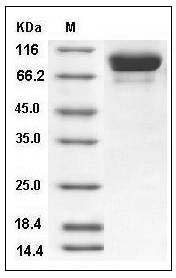 Influenza A H3N2 (A/Wyoming/03/2003) Hemagglutinin / HA Protein (His Tag) SDS-PAGE
